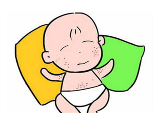 2017夏天孩子長(zhǎng)痱子有什么偏方 去治痱子偏方有哪些