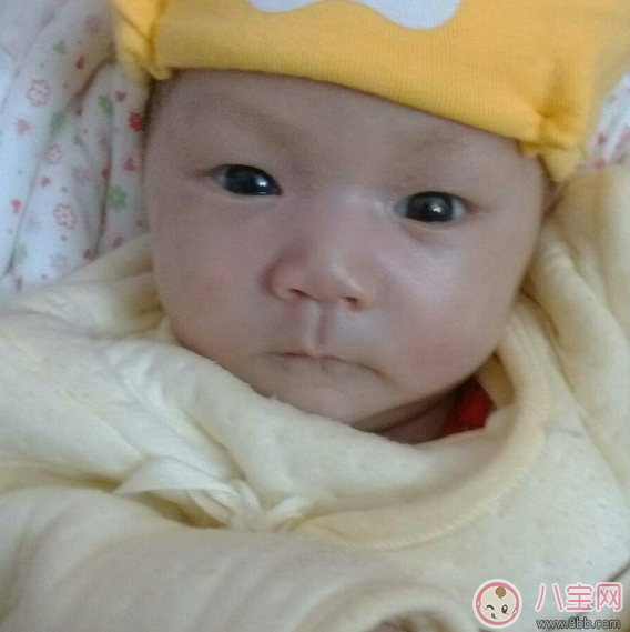 寶寶眼睛有好多眼屎需要馬上就醫(yī) 寶寶哪些情況千萬不能耽擱