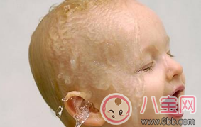 2017三伏天寶寶消化不良引起睡眠性出汗如何調理