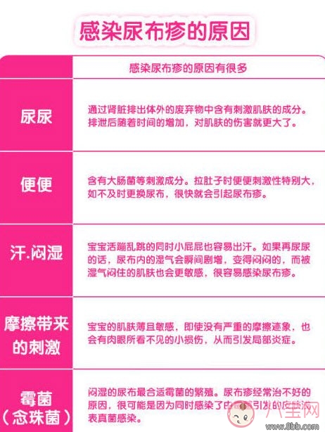 嬰兒長尿布疹怎么辦 尿布疹是怎么引起的 嬰兒長尿布疹怎么辦 尿布疹是怎么引起的