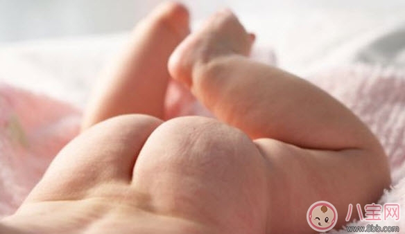 嬰兒長尿布疹怎么辦 尿布疹是怎么引起的 嬰兒長尿布疹怎么辦 尿布疹是怎么引起的