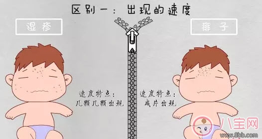 寶寶痱子和濕疹的區(qū)別 濕疹和痱子的區(qū)別圖片