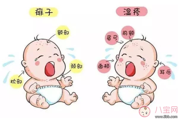 寶寶痱子和濕疹的區(qū)別 濕疹和痱子的區(qū)別圖片