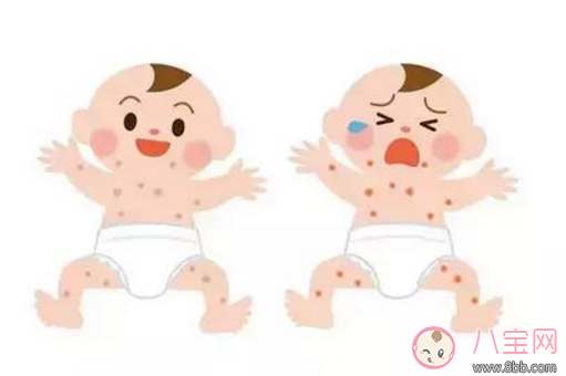 寶寶長(zhǎng)痱子怎么辦 給寶寶去痱子的方法有哪些