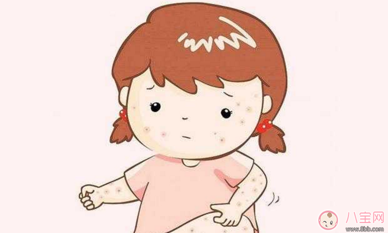 寶寶長(zhǎng)痱子怎么辦 給寶寶去痱子的方法有哪些