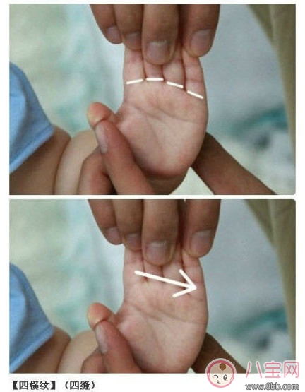 寶寶推拿大全 嬰幼兒常見病的最強克星