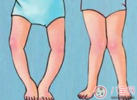 嬰兒扶站 寶寶過(guò)早被扶站的弊端(平衡感 O形腿 不愛(ài)爬) 嬰兒扶站 寶寶過(guò)早被扶站的弊端(平衡感 O形腿 不愛(ài)爬)