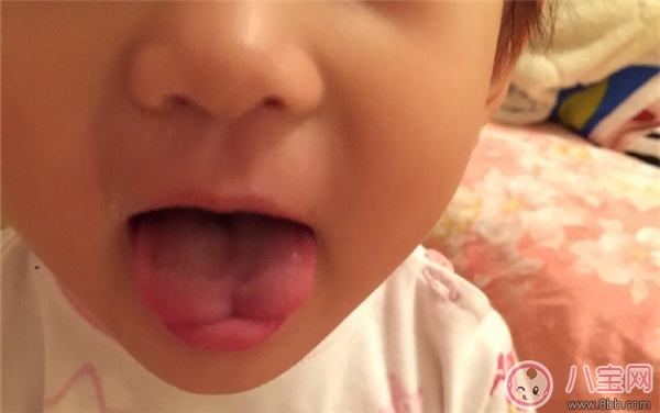 嬰兒舌尖正常該是什么形狀 為什么寶寶舌尖是w形狀