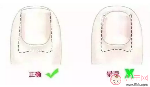 寶寶指甲太長抓人怎么辦    正確給寶寶剪指甲方法