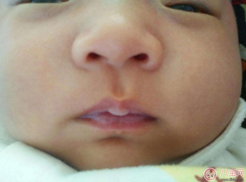 孩子脾虛的癥狀是什么 哪些情況是孩子脾虛了