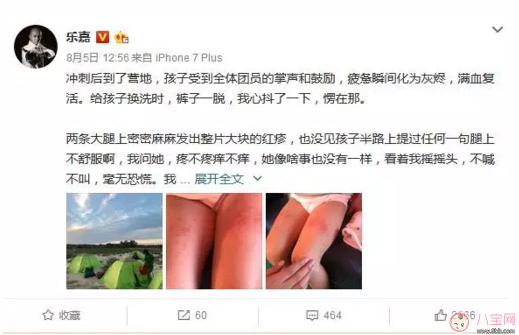樂嘉帶4歲女兒穿越沙漠徒步76公里 女兒腿上發(fā)滿皰疹