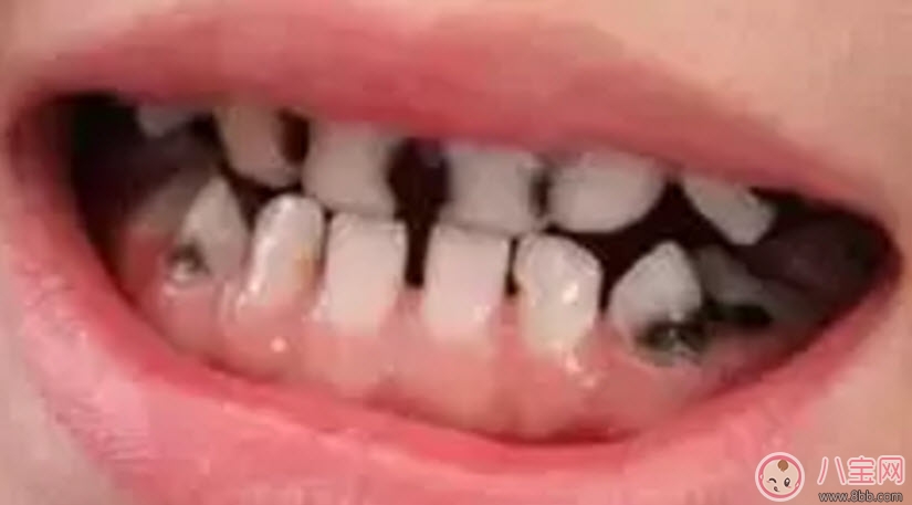 寶寶一直不愛刷牙 找對(duì)方法很關(guān)鍵