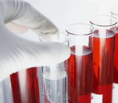 夢見去診所驗血