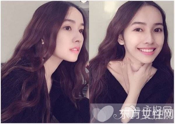 2017超流行蛋卷頭 7款韓式蓬松蛋卷發(fā)型推薦