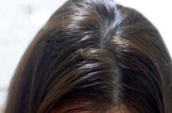 頭發(fā)油怎么辦 油性頭發(fā)的護發(fā)方法TOP8