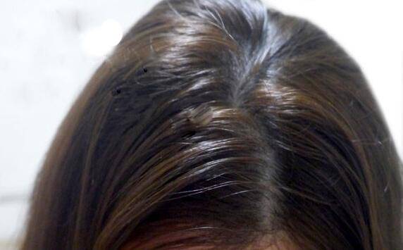 頭發(fā)油怎么辦 油性頭發(fā)的護(hù)發(fā)方法TOP8