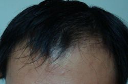 頭發(fā)護(hù)理小常識(shí) 怎樣讓頭發(fā)變多