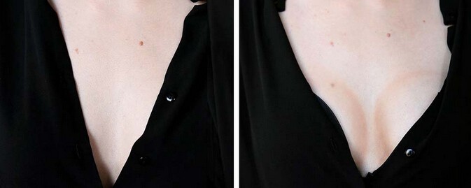 這樣也可以 不用動刀塑造豐滿胸部效果