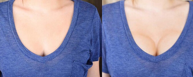 這樣也可以 不用動刀塑造豐滿胸部效果