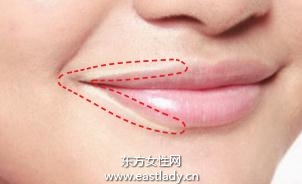 不易脫妝的局部遮瑕之矯正唇周與嘴角的色素沉淀