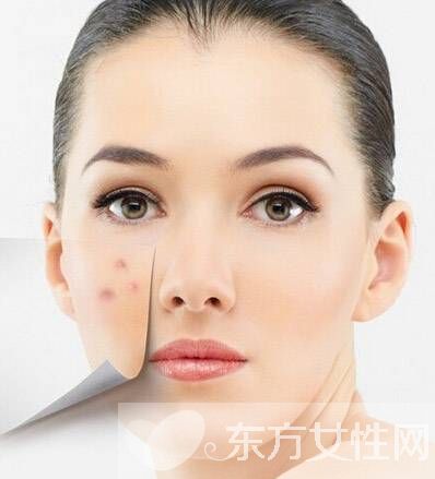 如何清除粉刺 粉刺和痘痘又有什么區(qū)別