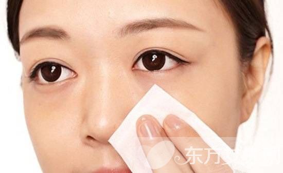 最有效去黑頭方法推薦 日常去黑頭小妙招超管用