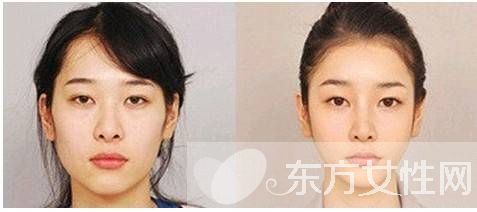 如何瘦臉最快最有效 這么做瞬變小v臉