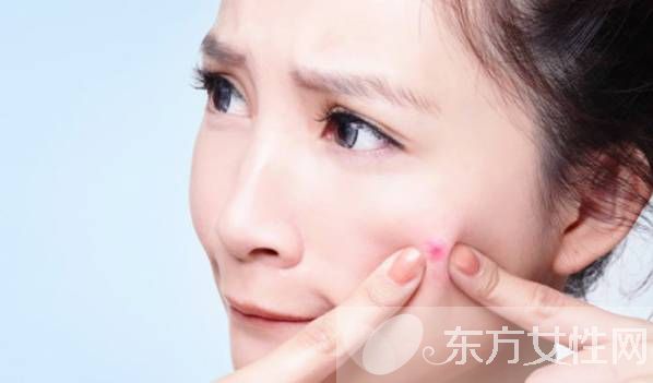 粉刺和痘痘的區(qū)別 這么做可以有效預防青春痘哦