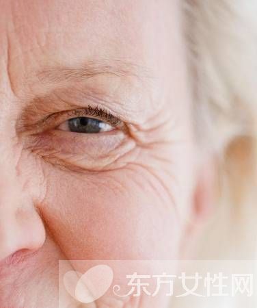 如何去眼部細紋 幾招趕跑魚尾紋