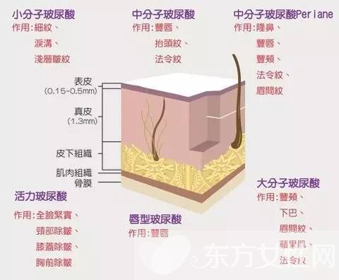 你知道注射玻尿酸需要多少錢嗎