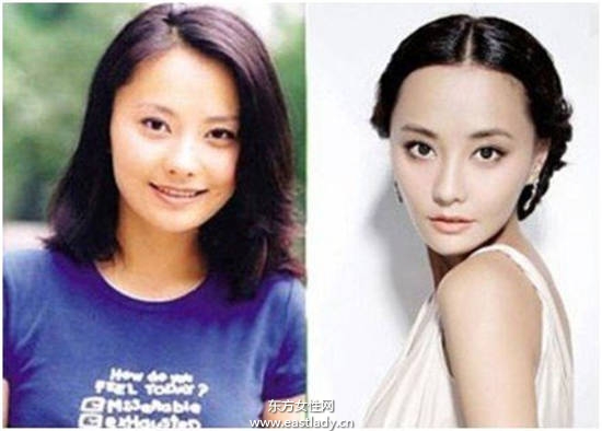 吳奇隆前妻馬雅舒被曝整形前像王寶強(qiáng)