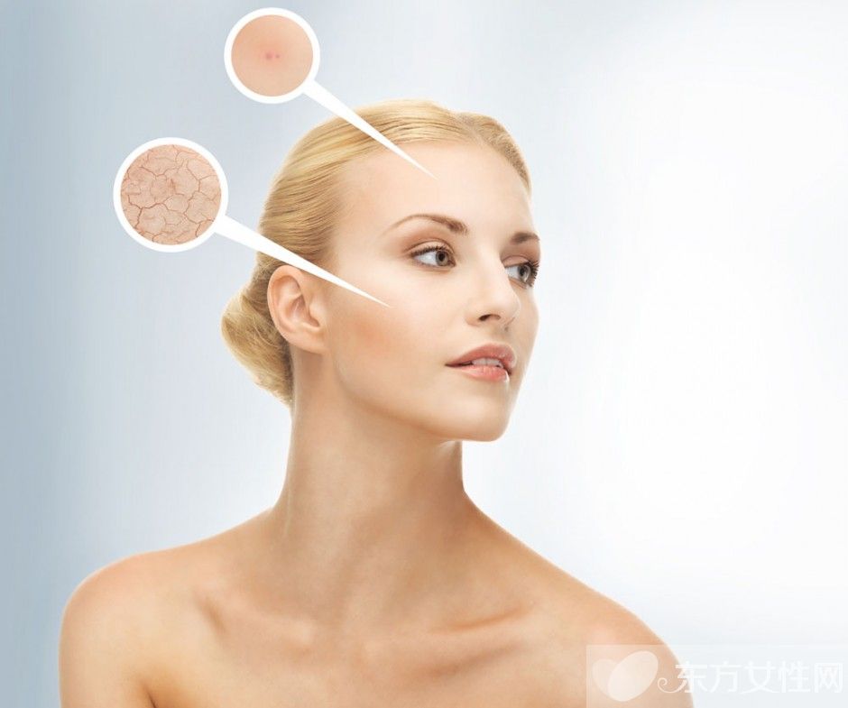 怎樣去眼袋最有效 6招教你如何預(yù)防眼袋