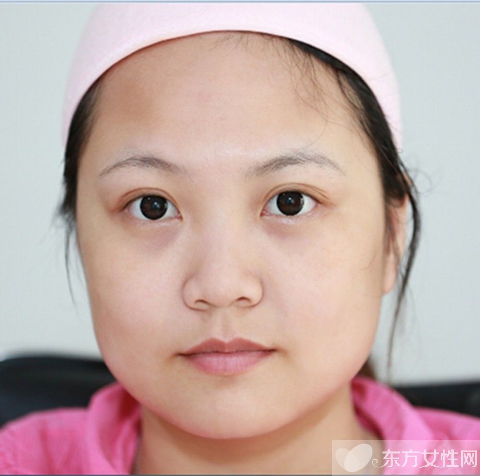 怎么去黑眼圈和眼袋 消除黑眼圈眼袋這么做就夠了