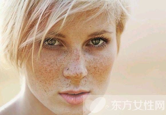 雀斑是怎么形成的 不花錢的雀斑去除方法推薦
