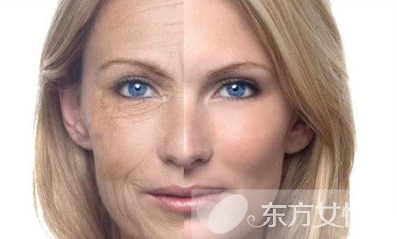 女人怎么做不易長(zhǎng)皺紋 這些地方長(zhǎng)皺紋謹(jǐn)防疾病