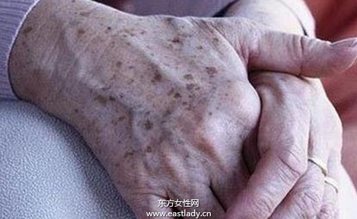 快速消除老年斑 老年斑的食療方法大全