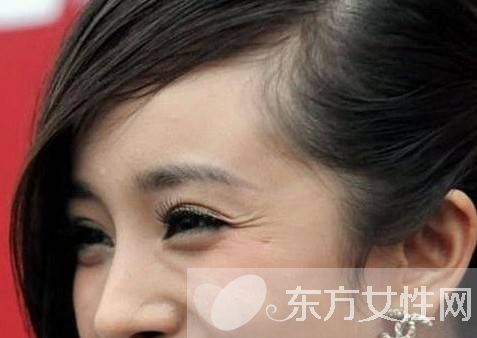 簡單按摩手法輕松去魚尾紋