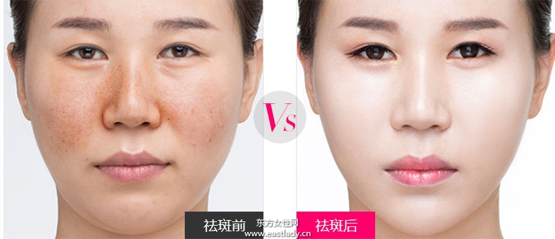 快速消除老年斑 老年斑的食療方法大全