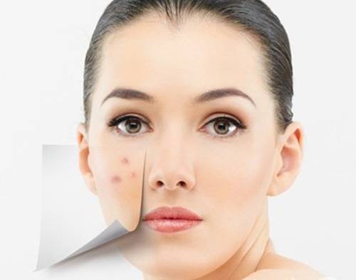 揭右臉長痘痘原因 三小妙招還你白嫩肌膚