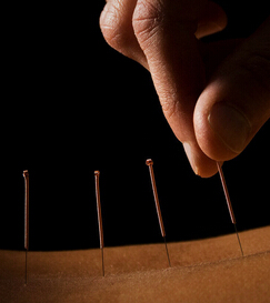 雀斑怎么去除 去除雀斑重塑無(wú)暇肌膚