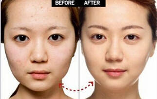 消浮腫瘦臉的偏方 荷葉薏仁面膜去水腫