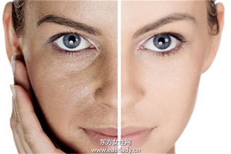 低成本擺脫皺紋  4個眼部抗皺妙招打擊女人最大天敵