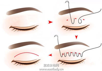 整形沒什么不好 日本男人最能夠接受女友整形的3個部位