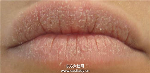 嘴唇干燥脫皮暗沉怎么辦 試試這個方法讓你嘴唇變的超粉嫩