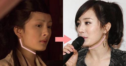楊冪是否整容 楊冪整容前后照片 楊冪整容后圖片