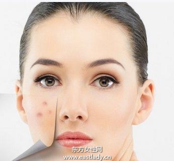 痊瘡皮膚的飲食調理法