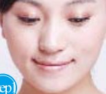 通過嘴形運(yùn)動(dòng)消除臉部皺紋