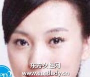 眼部舒展運(yùn)動延緩眼皮松弛