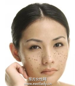 美白祛斑找準(zhǔn) 病源  從內(nèi)部下手