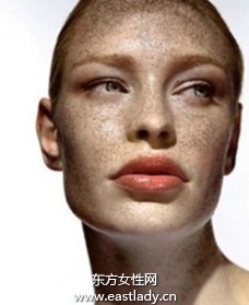 普通雀斑的日常護(hù)理方法